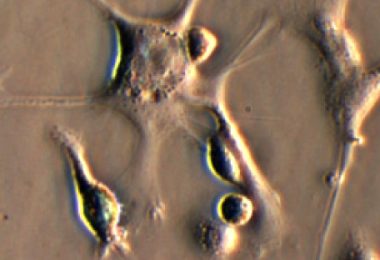 dendritic-cells-breast-cancer-stem-cells